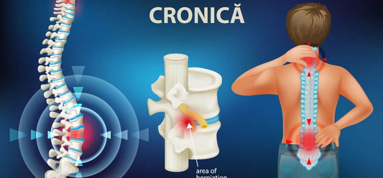 SIMPOZION CU TEMA: “DUREREA LOMBARĂ CRONICĂ ÎN CONTEXTUL PACIENTULUI CARDIOMETABOLIC”